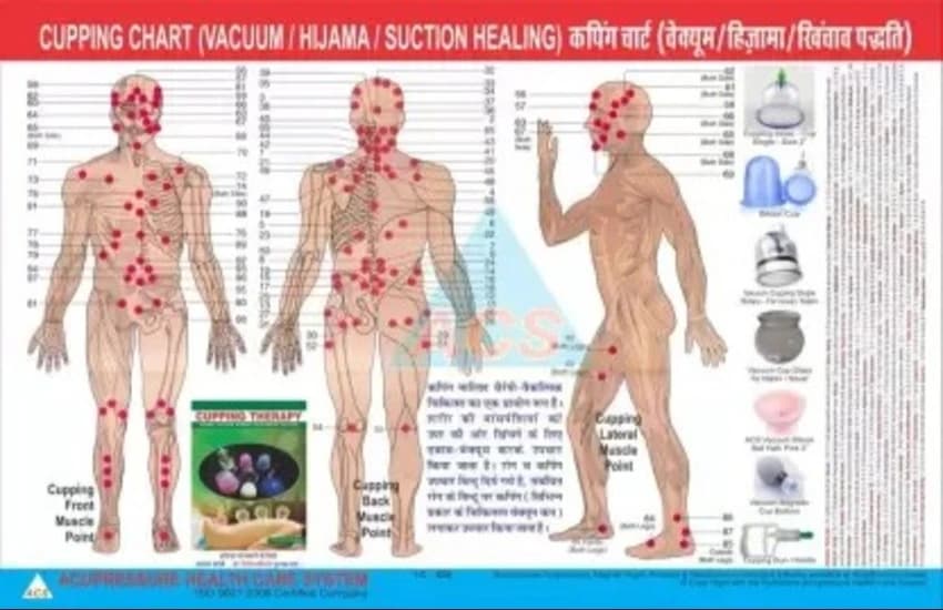 K524 Cupping Hijama Therapy Chart Professional Guide for Therapy & Acupressure